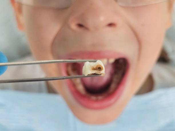 Best Emergency Dentist for Kids  in Deephaven, MN